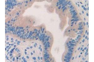 IHC-P analysis of Mouse Uterus Tissue, with DAB staining. (HYAL1 抗体  (AA 52-462))