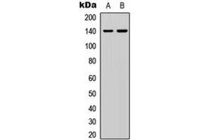 Western blot analysis of p140 Cap expression in HEK293T (A), HeLa (B) whole cell lysates. (SRCIN1 抗体  (Center))