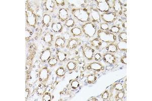 Immunohistochemistry (IHC) image for anti-Triosephosphate Isomerase 1 (TPI1) (AA 1-249) antibody (ABIN7270977)