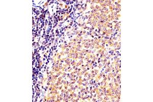 (ABIN6243917 and ABIN6577996) staining (Mouse) Nr4a2 in mouse spleen sections by Immunohistochemistry (IHC-P - paraformaldehyde-fixed, paraffin-embedded sections).