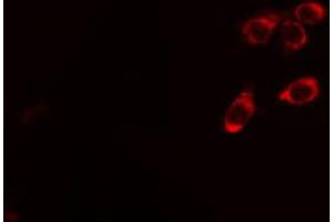 ABIN6267436 staining Hela cells by IF/ICC. (CBL 抗体  (pTyr674))