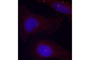 Immunofluorescence staining of methanol-fixed HeLa cells using Phospho-PTK2B-Y402 antibody (ABIN2987623). (PTK2B 抗体  (pTyr402))