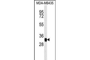 MTCH2 Antibody (N-term) (ABIN651683 and ABIN2840360) western blot analysis in MDA-M cell line lysates (35 μg/lane). (MTCH2 抗体  (N-Term))
