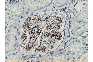 Immunohistochemical staining of paraffin-embedded Human Kidney tissue using anti-ADIPOQ mouse monoclonal antibody. (ADIPOQ 抗体  (AA 19-244))