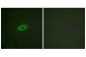 Immunofluorescence analysis of HeLa cells, treated with Forskolin (40nM, 30 mins), using Annexin A6 antibody. (ANXA6 抗体)