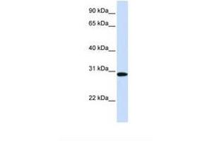 Image no. 1 for anti-Methylenetetrahydrofolate Dehydrogenase (NADP+ Dependent) 2, Methenyltetrahydrofolate Cyclohydrolase (MTHFD2) (AA 36-85) antibody (ABIN6738218)