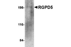 Western Blotting (WB) image for anti-RANBP2-Like and GRIP Domain Containing 5 (RGPD5) (N-Term) antibody (ABIN1031536) (RGPD5 抗体  (N-Term))