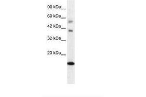 Image no. 2 for anti-BolA-like Protein 1 (BOLA1) (AA 24-73) antibody (ABIN6735869) (BOLA1 抗体  (AA 24-73))