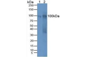 Western blot analysis of (1) Human Hela Tissue and (2) Mouse Ovary Tissue. (MUC16 抗体  (AA 2-258))