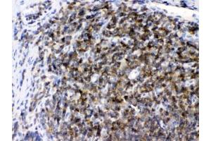 IHC testing of FFPE rat lymph tissue with ARHGEF1 antibody at 1ug/ml. (ARHGEF1 抗体  (AA 41-71))