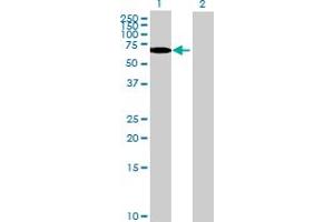 Western Blot analysis of TULP2 expression in transfected 293T cell line by TULP2 MaxPab polyclonal antibody. (TULP2 抗体  (AA 1-520))