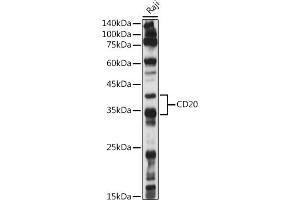 Western blot analysis of extracts of Raji cells, using CD20 antibody (ABIN7268473) at 1:1000 dilution. (CD20 抗体  (AA 208-297))