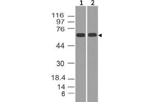 Image no. 1 for anti-Tumor Protein P73 (TP73) antibody (ABIN5027773) (Tumor Protein p73 抗体)