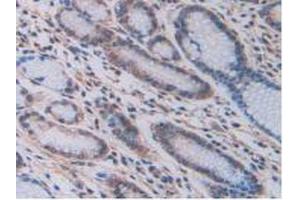 IHC-P analysis of Human Stomach Tissue, with DAB staining. (LOXL2 抗体  (AA 544-751))