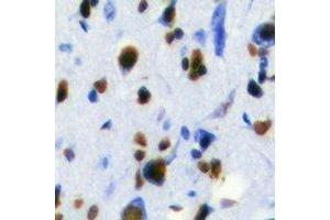 Immunohistochemistry (IHC) image for anti-RAB3A Interacting Protein (Rabin3) (RAB3IP) antibody (ABIN7308252) (RAB3IP 抗体)