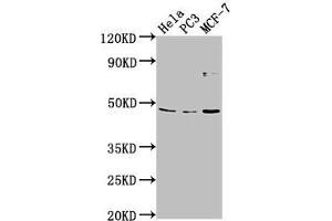 Western Blot Positive WB detected in: Hela whole cell lysate, PC-3 whole cell lysate, MCF-7 whole cell lysate All lanes: TMEM237 antibody at 1:2000 Secondary Goat polyclonal to rabbit IgG at 1/50000 dilution Predicted band size: 46, 45, 49, 36, 47 kDa Observed band size: 46 kDa (TMEM237 抗体  (AA 59-78))
