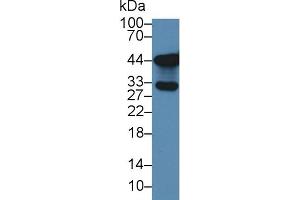 Detection of SLC9A3R2 in Human Lung lysate using Polyclonal Antibody to Sodium Hydrogen Exchange Regulatory Cofactor 2 (SLC9A3R2)