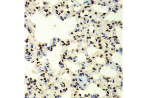 Immunohistochemistry of paraffin-embedded rat lung using SUMO2 antibody (ABIN6128719, ABIN6148726, ABIN6148728 and ABIN6218594) at dilution of 1:100 (40x lens). (SUMO2 抗体  (AA 1-95))