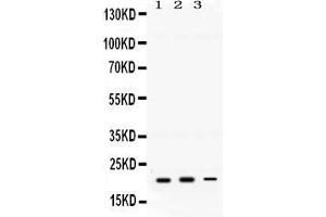 Anti-GTPase HRAS antibody, Western blotting All lanes: Anti GTPase HRAS  at 0. (HRAS 抗体  (C-Term))