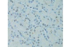 Immunohistochemistry of paraffin-embedded Rat pancreas using GTF2H2C Polyclonal Antibody at dilution of 1:100 (40x lens). (GTF2H2C 抗体)