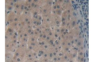 Detection of HMGCS in Human Liver Tissue using Polyclonal Antibody to Hydroxymethylglutaryl Coenzyme A Synthase (HMGCS) (HMGCS1 抗体  (AA 293-467))
