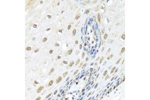 Immunohistochemistry of paraffin-embedded human esophagus using ELAC2 antibody at dilution of 1:100 (x40 lens). (ELAC2 抗体)