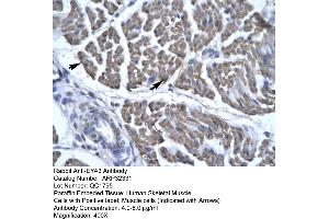 Human Skeletal Muscle (EYA3 抗体  (Middle Region))