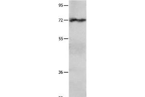 Western Blot analysis of Hela cell using IGF2BP1 Polyclonal Antibody at dilution of 1:750 (IGF2BP1 抗体)