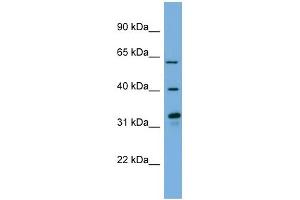 WB Suggested Anti-FMO3 Antibody Titration:  0. (FMO3 抗体  (N-Term))
