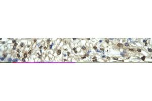 Rabbit Anti-FLI1 Antibody       Paraffin Embedded Tissue:  Human cardiac cell   Cellular Data:  Epithelial cells of renal tubule  Antibody Concentration:   4. (FLI1 抗体  (Middle Region))