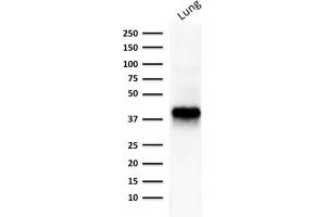 Western Blot Analysis of human lung lysate using EpCAM Mouse Monoclonal Antibody (EGP40/1373).