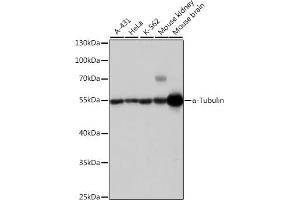 Western blot analysis of extracts of various cell lines, using α-Tubulin antibody (ABIN3020549, ABIN3020550 and ABIN3020551) at 1:1000 dilution. (TUBA4A 抗体  (AA 1-180))