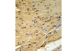 Immunohistochemistry analysis in formalin fixed and paraffin embedded mouse heart tissue using PLB-Thr17 followed by peroxidase conjugation of the secondary antibody and DAB staining. (Phospholamban 抗体  (Thr17))