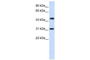 Western Blotting (WB) image for anti-Zinc Finger Protein 684 (ZNF684) antibody (ABIN2458119) (ZNF684 抗体)