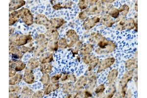 IHC analysis of PCK1/PEPC using anti-PCK1/PEPC antibody (ABIN7599502).