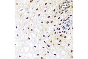 Immunohistochemistry of paraffin-embedded human esophageal using UB Rabbit mAb (ABIN7271185) at dilution of 1:100 (40x lens). (UBA1 抗体)