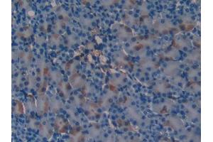 DAB staining on IHC-P; Samples: Mouse Kidney Tissue (SERPINA6 抗体  (AA 57-256))