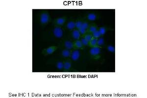 Immunohistochemistry (IHC) image for anti-Carnitine Palmitoyltransferase 1B (Muscle) (CPT1B) (Middle Region) antibody (ABIN2782633)