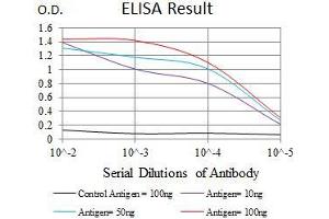 Black line: Control Antigen (100 ng), Purple line: Antigen(10 ng), Blue line: Antigen (50 ng), Red line: Antigen (100 ng), (Paired Box 3 抗体  (AA 142-203))