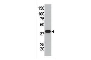 The anti-SUMO1 polyclonal antibody (ABIN388027 and ABIN2845493) is used in Western blot to detect GST-SUMO1 fusion protein. (SUMO1 抗体  (C-Term))