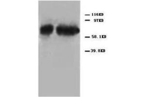 Western blot analysis of Hela cell lysis using P73alpha antibody (Tumor Protein p73 抗体  (C-Term))