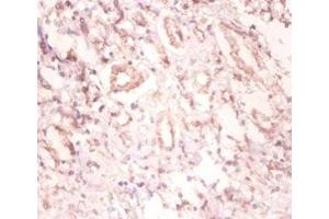 Immunohistochemistry of paraffin-embedded human kidney tissue using ABIN7174131 at dilution of 1:100 (SNRPA1 抗体  (AA 8-278))
