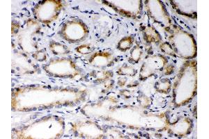 Immunohistochemistry (IHC) image for anti-Estrogen Receptor Binding Site Associated, Antigen, 9 (EBAG9) (AA 31-213) antibody (ABIN3043569)