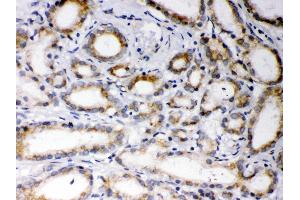 Anti- EBAG9 Picoband antibody,IHC(P) IHC(P): Human Prostatic Cancer Tissue (RCAS1 抗体  (AA 31-213))