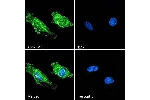 (ABIN570758) Immunofluorescence analysis of paraformaldehyde fixed HeLa cells, permeabilized with 0. (SMC5 抗体  (Internal Region))