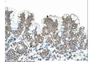 Image no. 1 for anti-Salt-Inducible Kinase 1 (SIK1) (N-Term) antibody (ABIN321003) (SIK1 抗体  (N-Term))