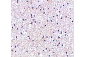Immunohistochemistry of MORF4 in human brain tissue with MORF4 antibody at 5 μg/ml. (MORF4 抗体  (N-Term))