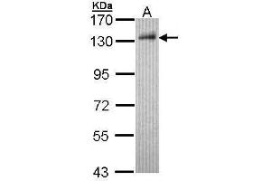 WB Image Sample (30 ug of whole cell lysate) A: Hep G2 , 7. (DDB1 抗体  (C-Term))