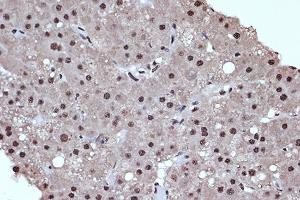 Immunohistochemistry (IHC) image for anti-Histone Deacetylase 8 (HDAC8) antibody (ABIN7267714)