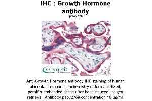 Image no. 1 for anti-Growth Hormone 1 (GH1) antibody (ABIN1735292) (Growth Hormone 1 抗体)